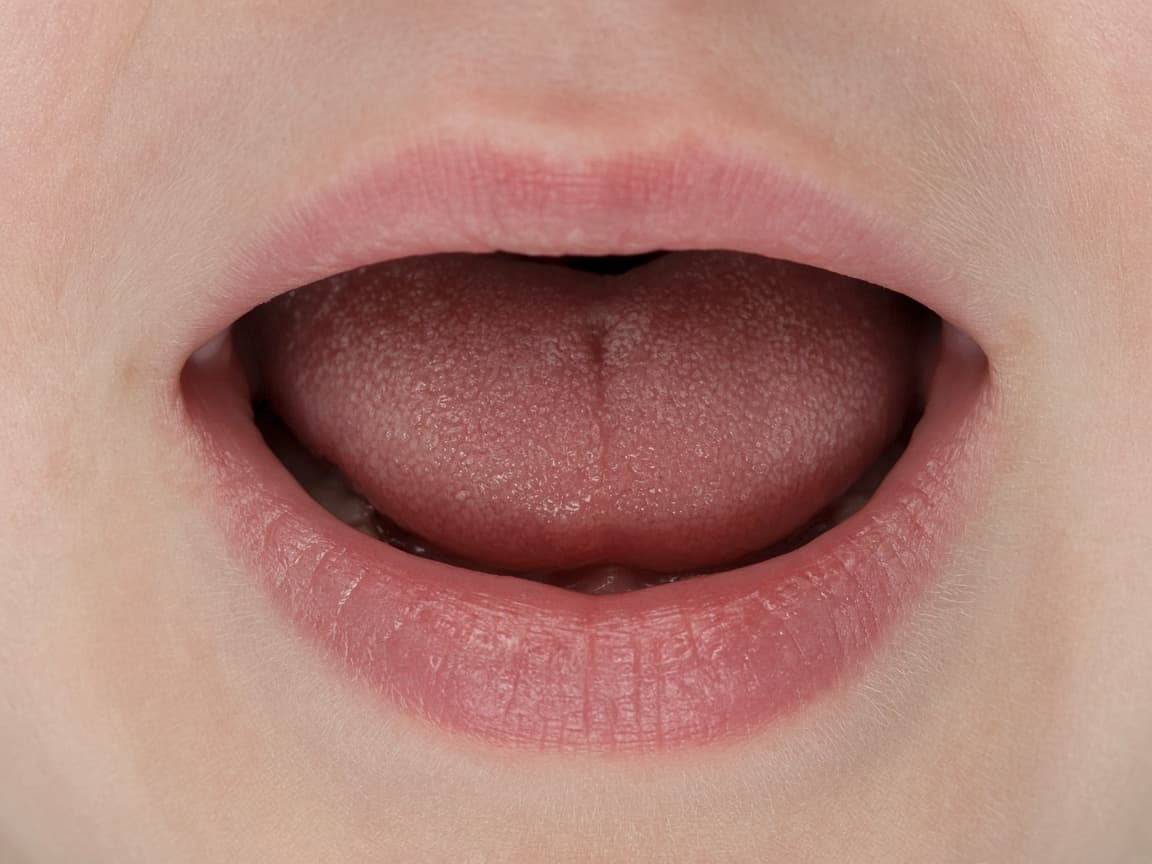 Close view of oral rest posture