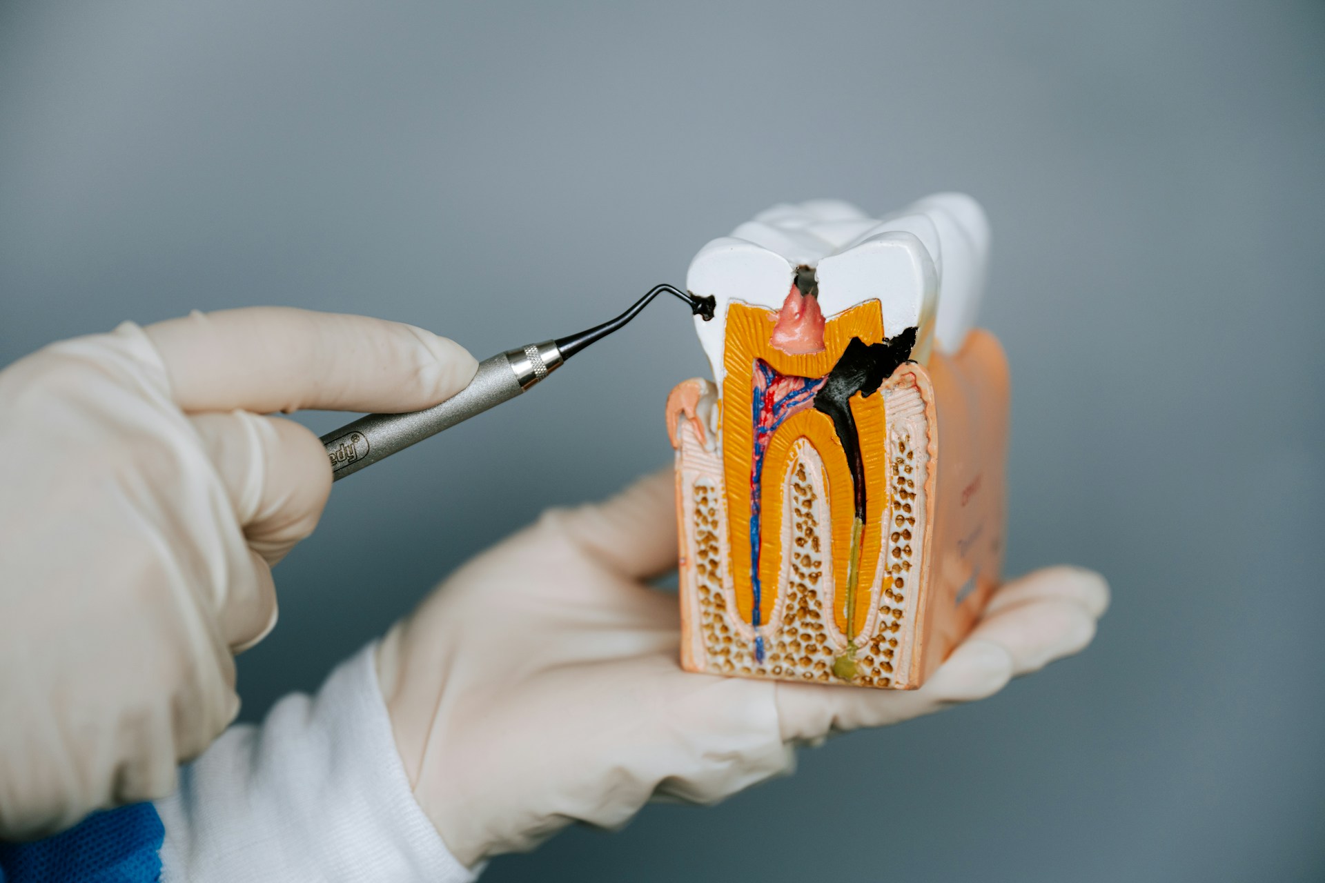 Tethered Oral Tissues
